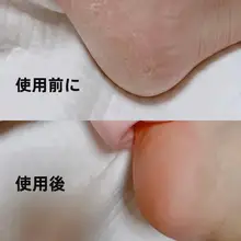 かかと保湿ケアソックス【死皮除去・シリコン製・乾燥防止】