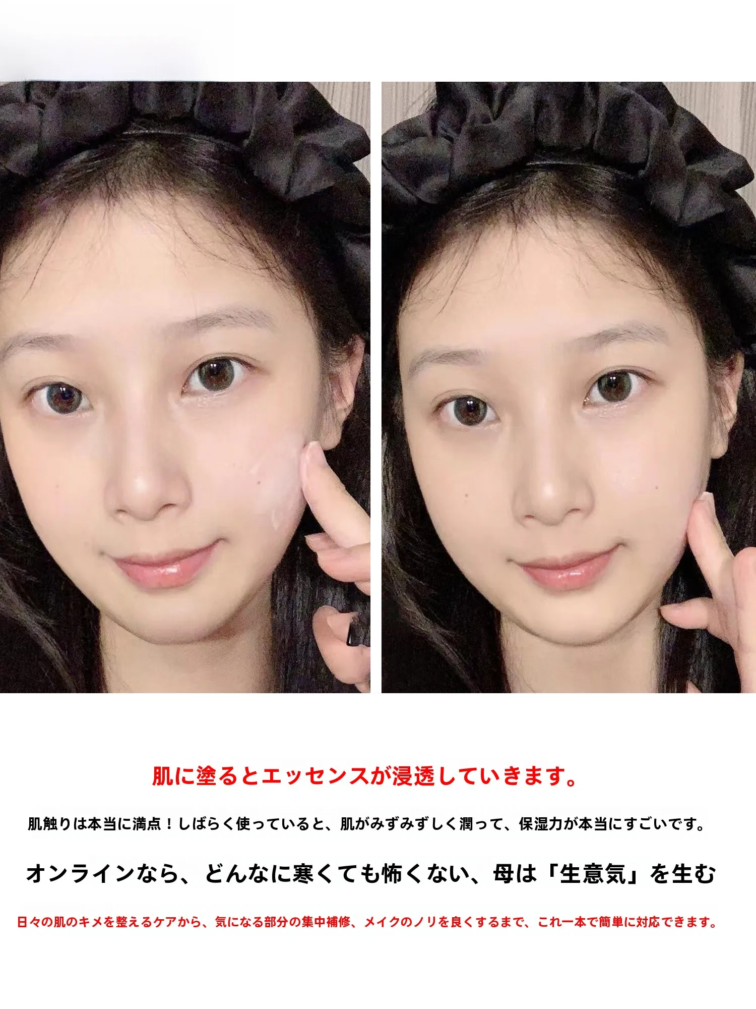 フォッケア エデュリスは敏感肌向けの厚膜クリームで、バリア修復と潤いを実現