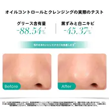 クレイマスク 毛穴ケア 皮脂吸着 うるおい 肌に優しい 毛 穴引き締め