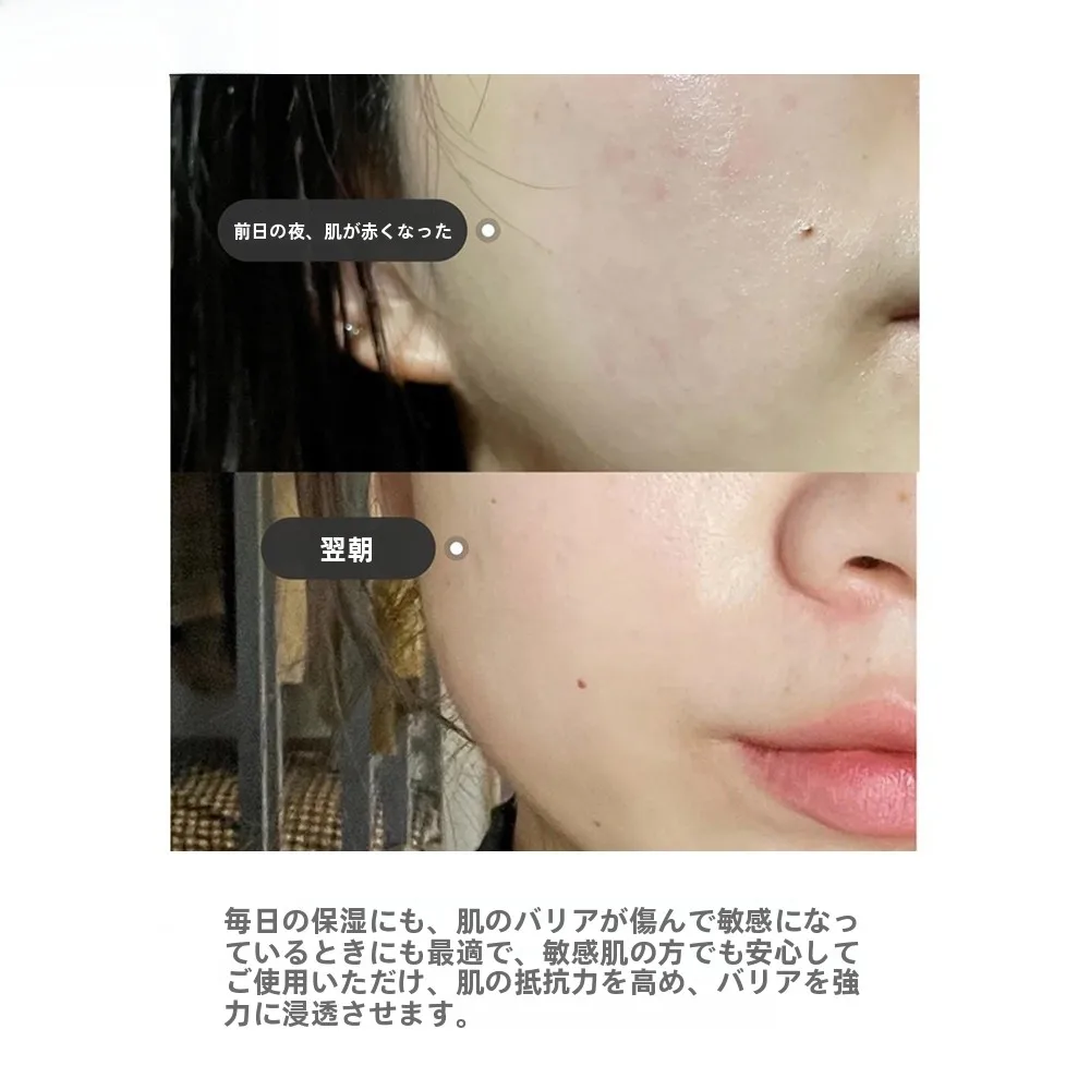神経酰胺B5セラム：aha成分とは何か？保湿修復に最適な実証データと使用ガイド