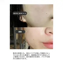 保湿補水・修復・緩和に最適な神経酰胺セラム