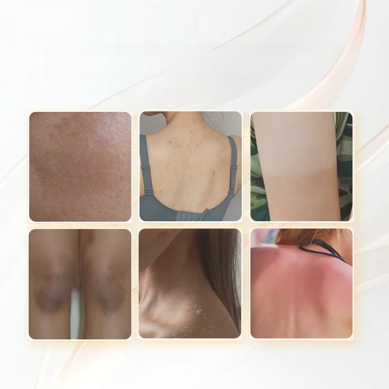 40代男性の体メンテナンスで、美白ボディローションは本当に必要なのか？