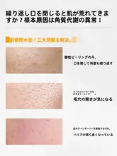 皮脂コントロール・保湿・毛穴を整える化粧水【湿布用・スキンケア】