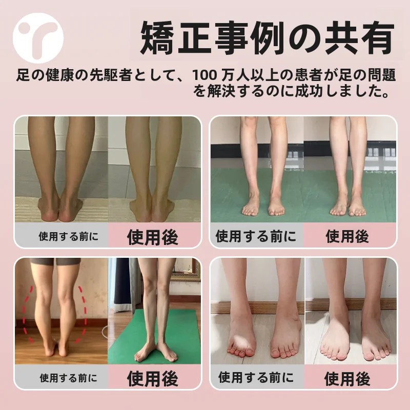 足弓トレーニング器具【扁平足・女性用・サポート機能・足底強化】