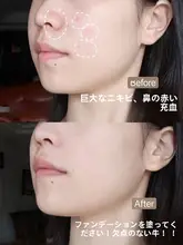 三色コンシーラー【タトゥー隠し・ニキビ跡やしみ・顔の傷用】