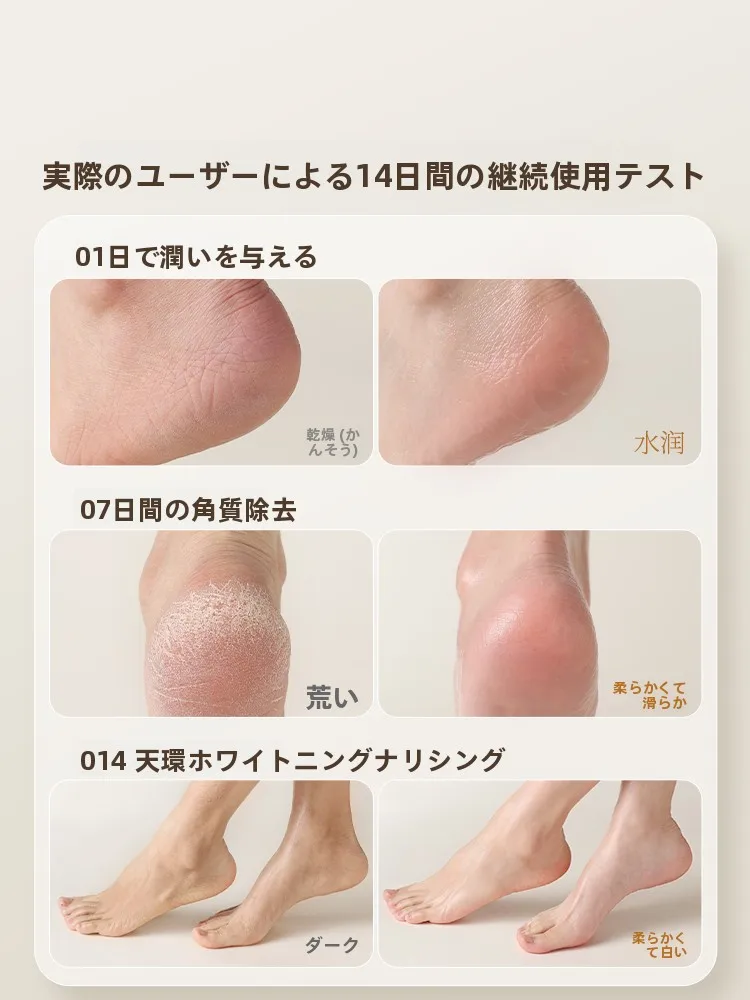 足裏角質除去パックは本当に効果的？古迪白茶足膜が選ばれる理由とは