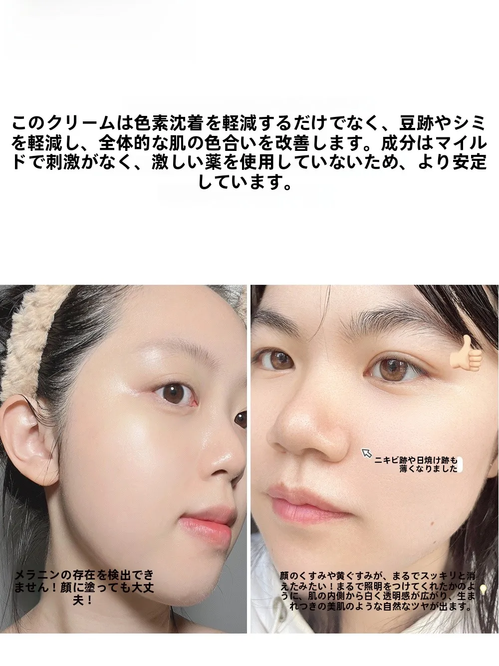 30代から50代にかけてシミに効くオールインワンはどれがおすすめ？