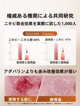 RUYI 肌をリフレッシュ！ニキビ修復パッチマスク【保湿・トラブルケア・女性用】
