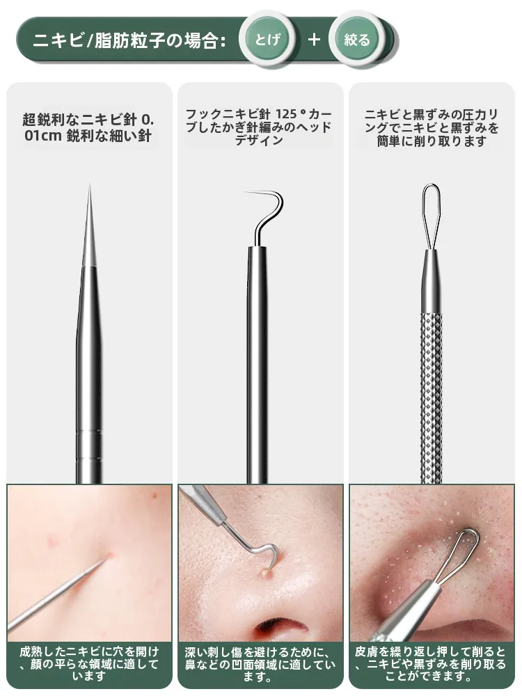 ニキビ治療に効果的なアイテムは？5選で肌の悩みを根本から解決する方法