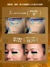 アイオイル アイセラム アイクリーム 引き締め 防シワ 小ジワケア マッサージ 目元 2.0