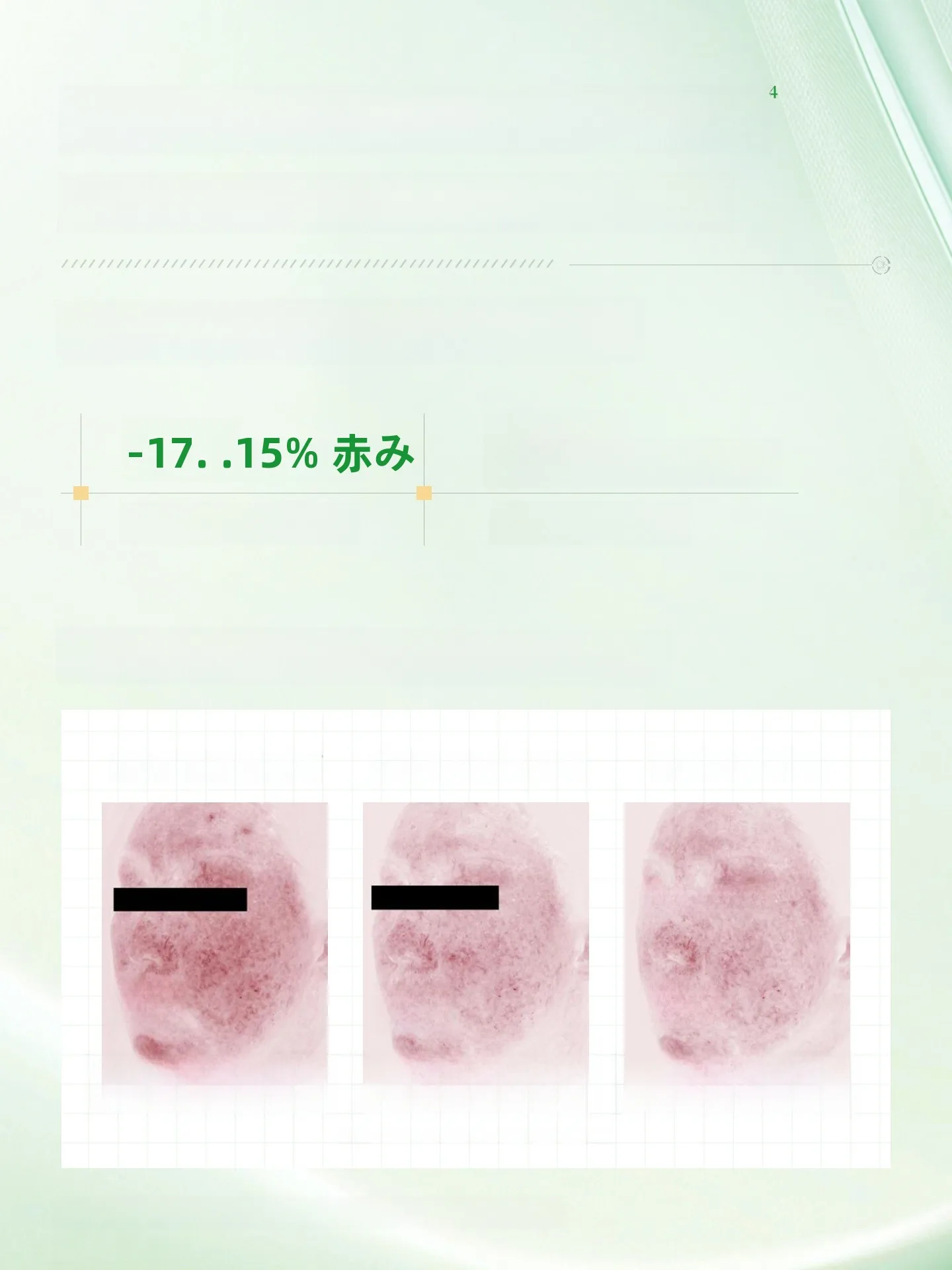 30代の敏感肌に合う化粧水はどれ？マーチ草発酵エッセンス水が解決するリアルな悩みとは