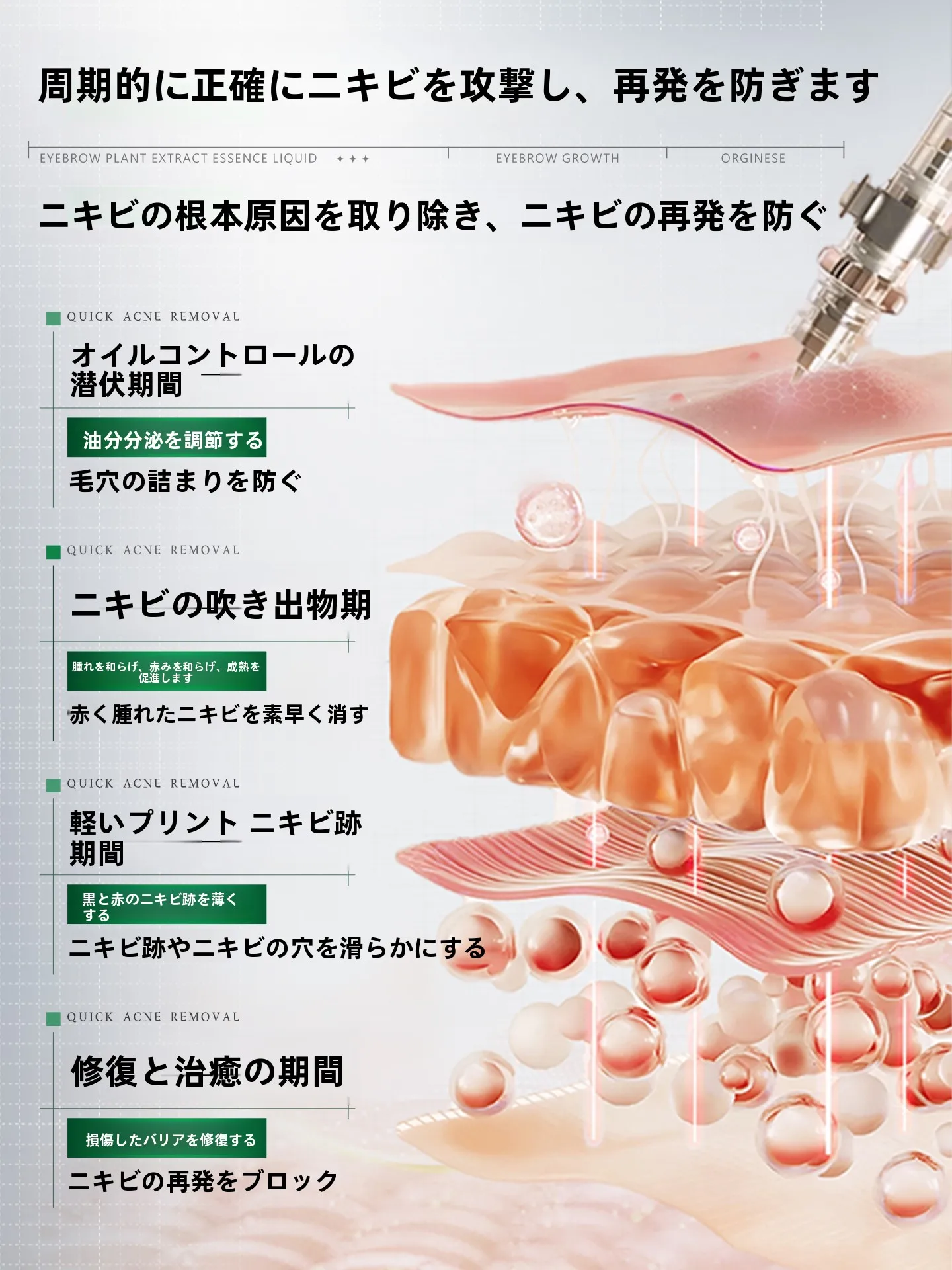 アカセラ治療とニキビケアの違いは？欧橘の無酸性ニキビ専用美容液が解決するリアルな悩みとは