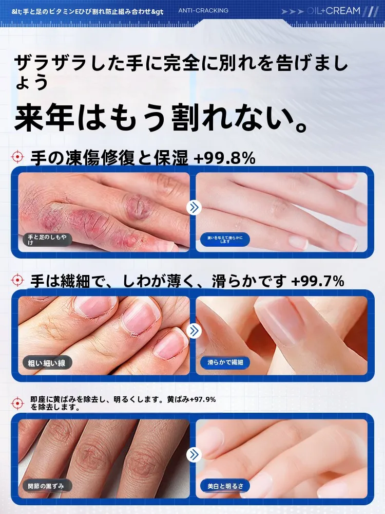 手のストレッチで疲れを和らげるなら、まずは肌の潤いから始める？