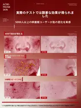 RUYI 肌をリフレッシュ！ニキビ修復パッチマスク【保湿・トラブルケア・女性用】