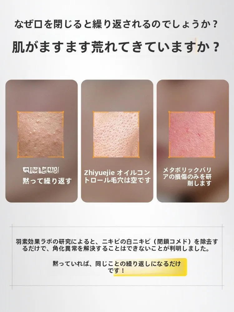 毛穴引き締め効果のある保湿化粧水：敏感肌向けの皮脂コントロールと毛孔ケア