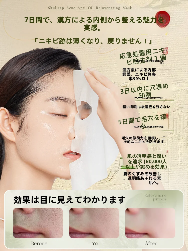 敏感肌用黄芩净痘控油焕肤面膜：たるみ毛穴改善に効果的な油分コントロールケア