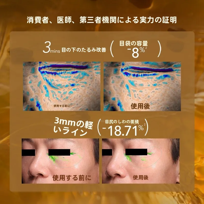 50代男性の目のしわに効くエイジングケアは？目元のハリをもたらすエッセンスオイルがおすすめ