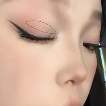 レースタイプの二重まぶたフィルム【無痕・自然な仕上がり・女性用】