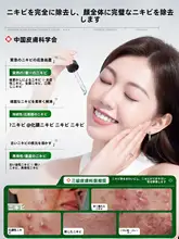 無酸性ニキビ専用美容液【ニキビ跡ケア・毛穴引き締め・黒色素淡化】
