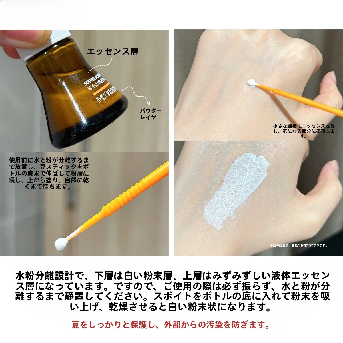 アカセラ治療とニキビ用エッセンス、どちらが本当の解決法か？