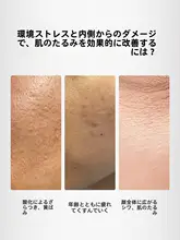 春の訪れを感じるVCエッセンス【引き締め・抗皺・明るさアップ】（セットアップ対応）