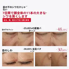 MARUBI丸美 アイクリーム ペンタイプ クマ対策 小じわケア 防シワ 引き締め