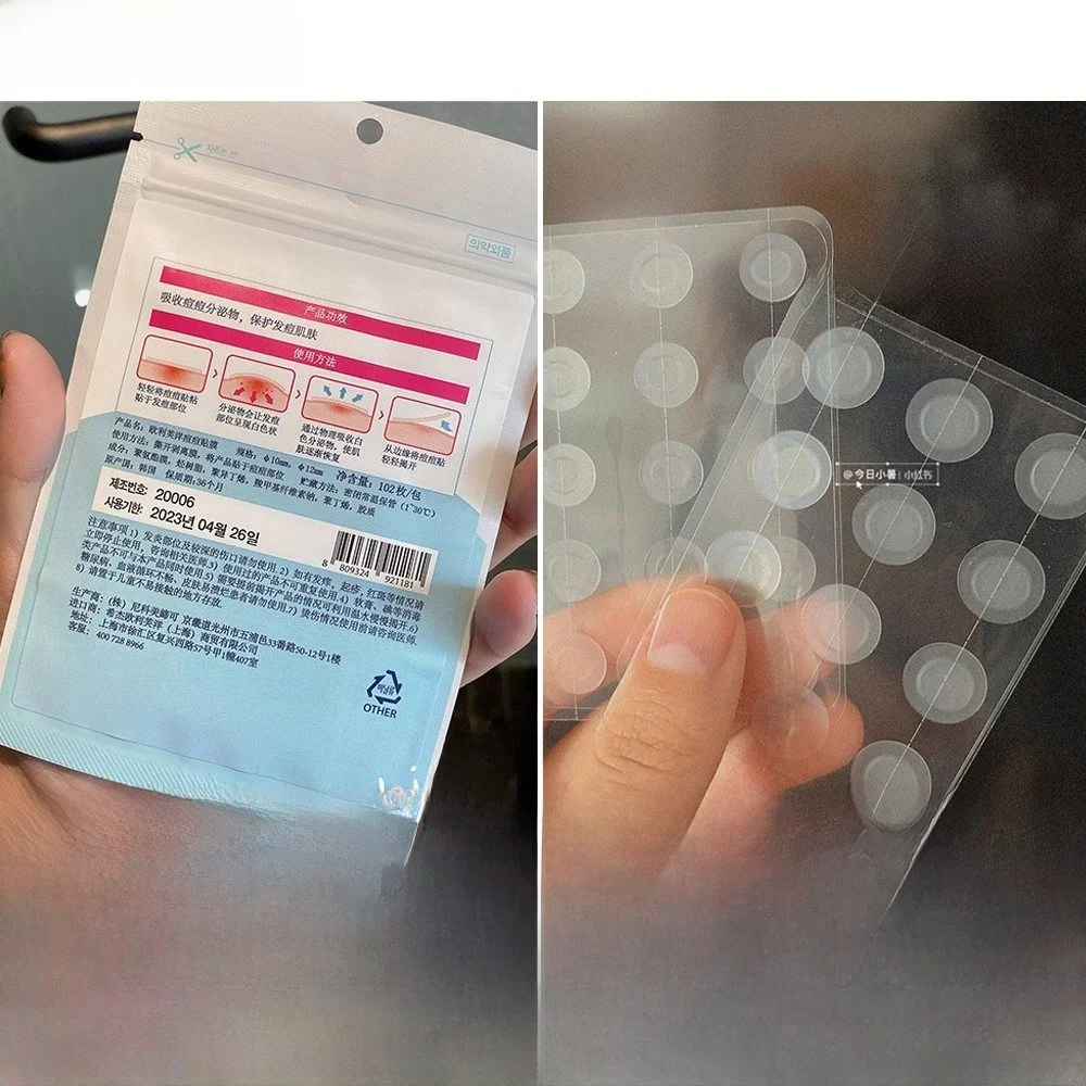 こめかみニキビに効く軽量ニキビパッチの実用性と使用シーン