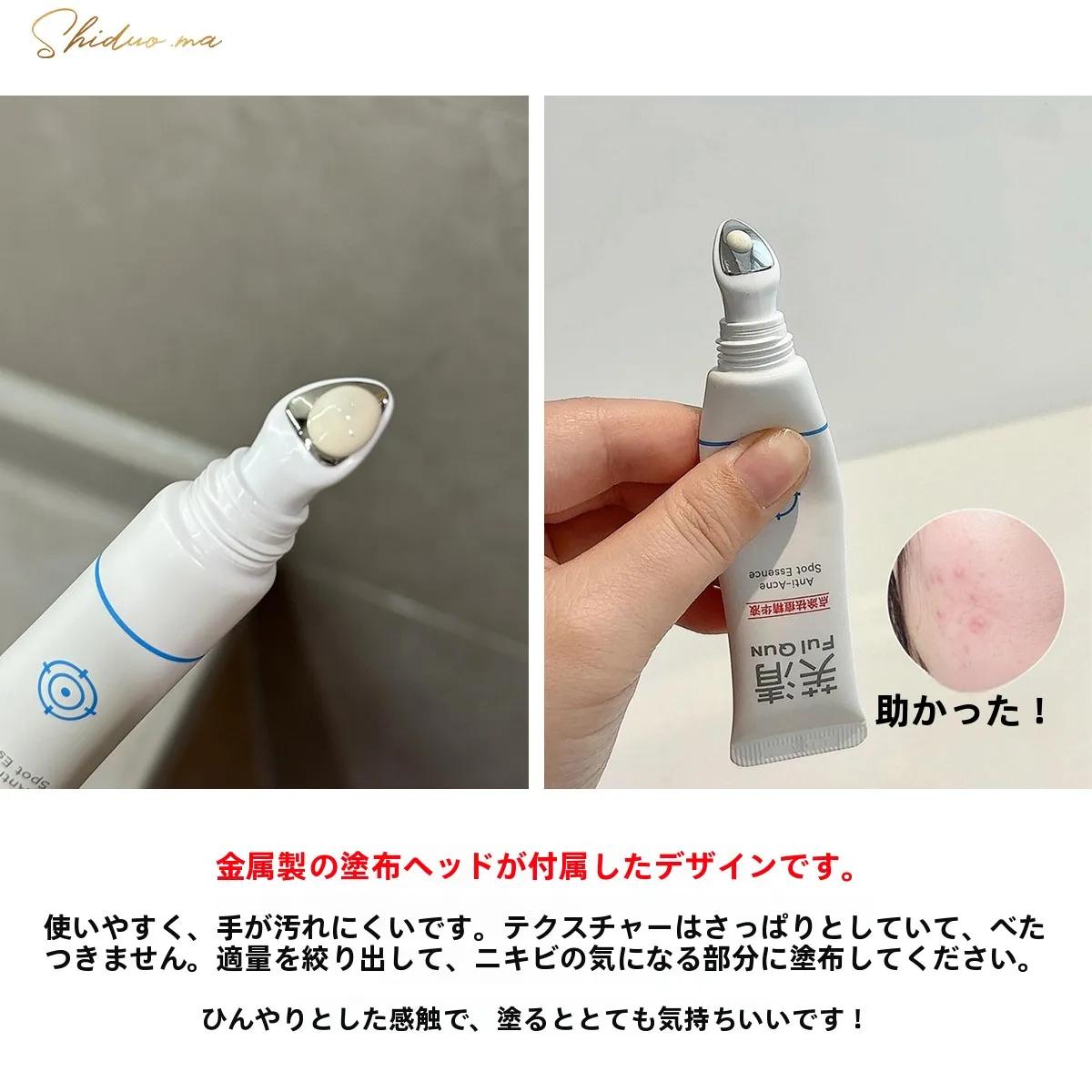 ニキビケアエッセンス：敏感肌向けのスポットケアですぐ治すための実証データ