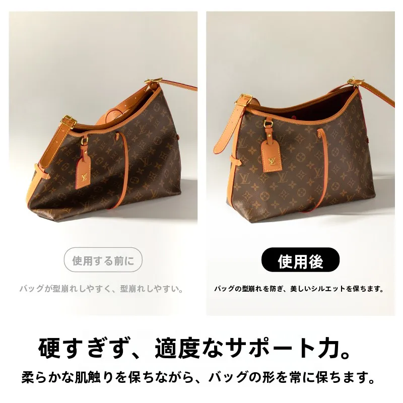 キャリーケースにつけられるバッグは、本当に必要なの？