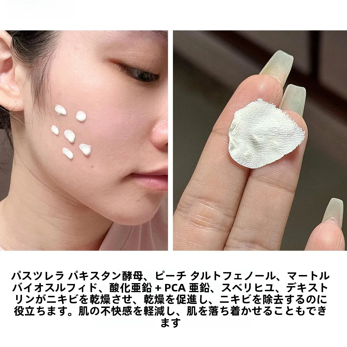 ニキビケアエッセンス：敏感肌向けのスポットケアですぐ治すための実証データ