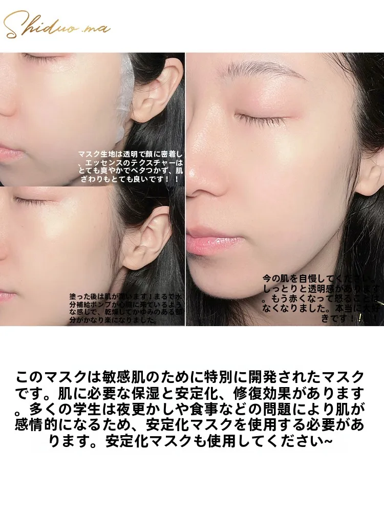 敏感肌の肌荒れに効く美容マスクは？B5成分配合の保湿マスクが本当の救世主になる
