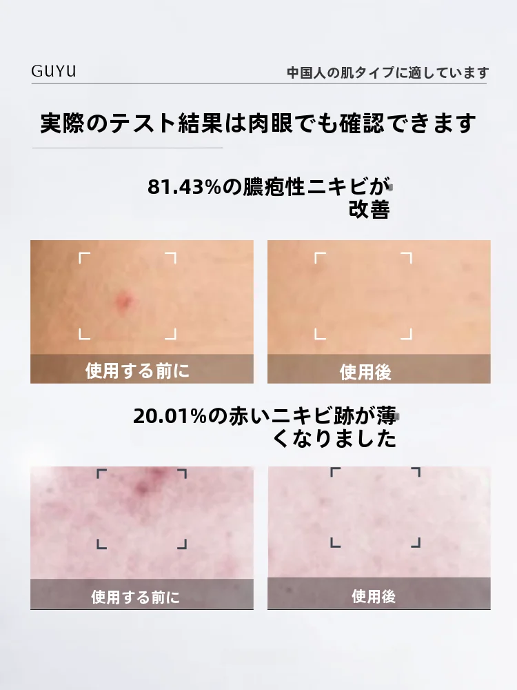 40代男性向けスキンケアの選択肢として、控油修護乳液の実効性とは？