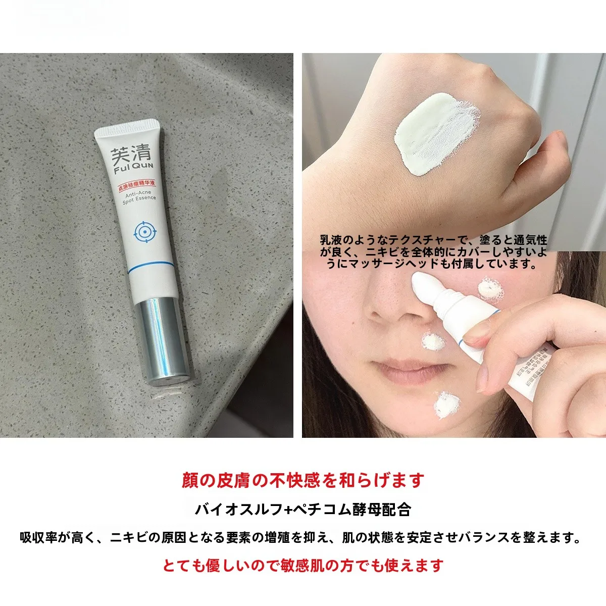 ニキビケアエッセンス：敏感肌向けのスポットケアですぐ治すための実証データ