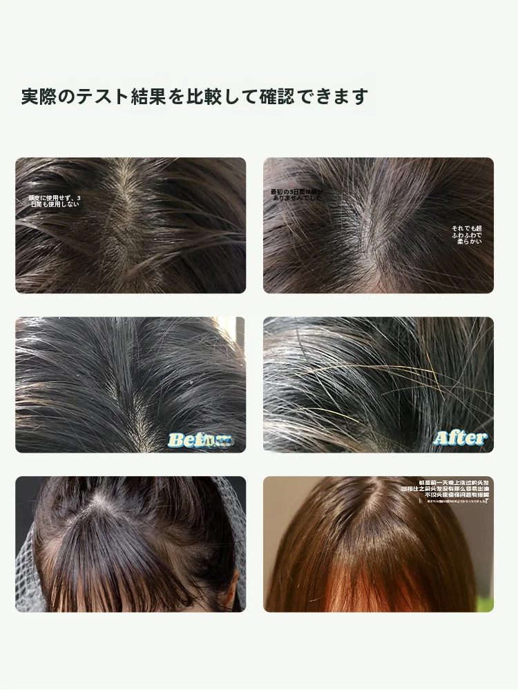 頭皮炎症に効果的なシャンプーはどれが本当の救世主なのか？