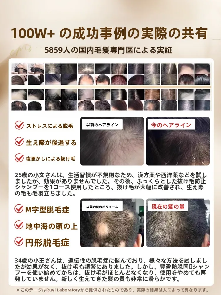 あせとせっけんとうねりケア、おでこケアの違いは？本当に効果があるのか？
