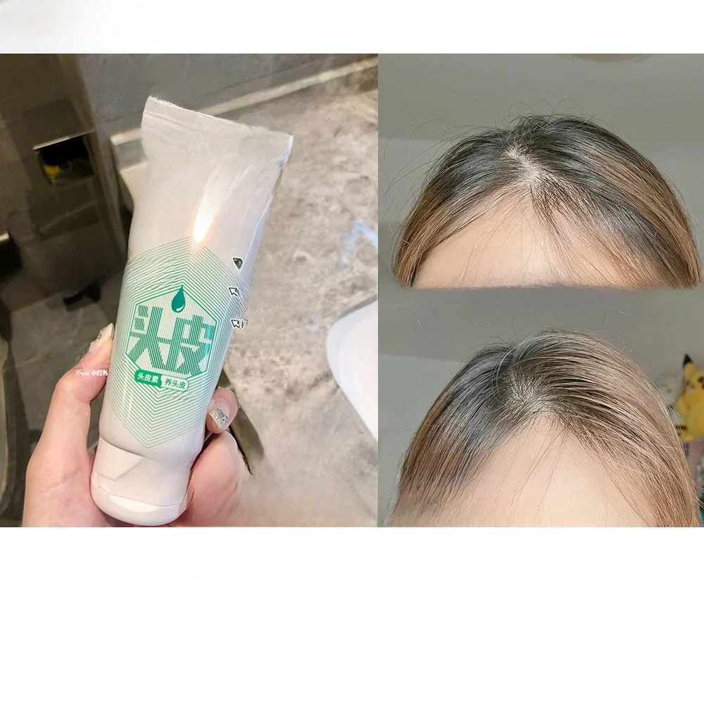 頭皮炭酸スプレーは本当に効くの？青蒿成分の修復エッセンスが解決する、頭皮の悩みとは？