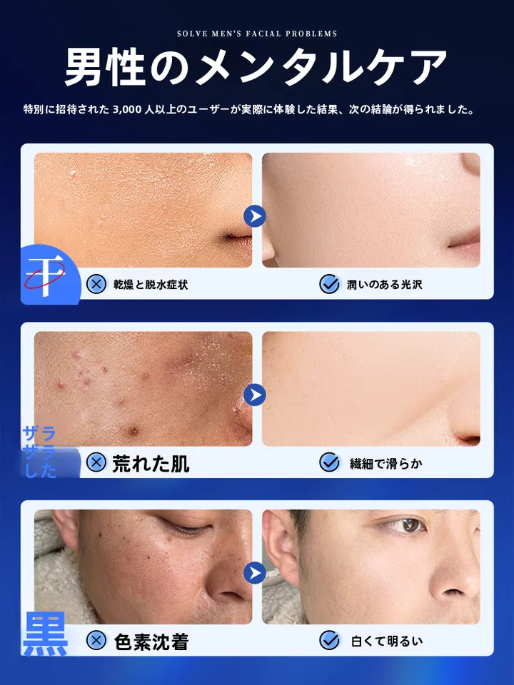 男性用保湿クリーム【秋冬用・白鹅绒配合・水分補給・肌荒れ防止】