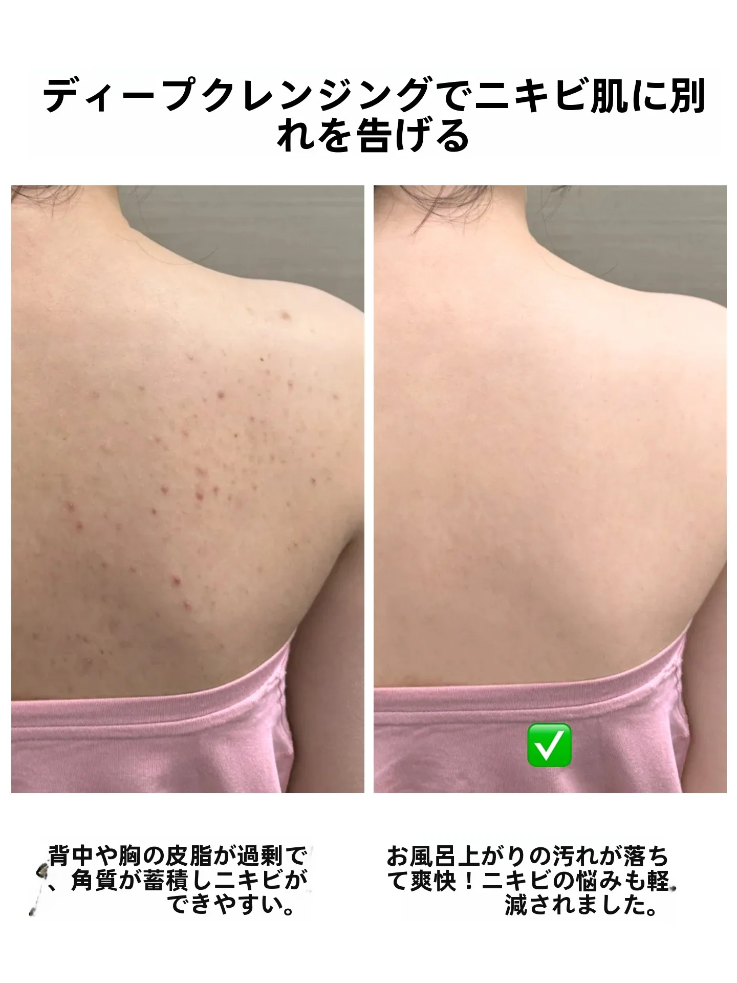 お風呂快適グッズとしての背中用タオルグローブの実用性と効果