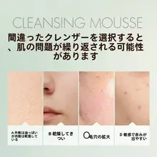 山茶花 保湿クレンジングムース【女性用・アミノ酸・肌に優しい】